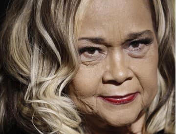 Speváčku Ettu James hospitalizovali, dýchajú za ňu prístroje