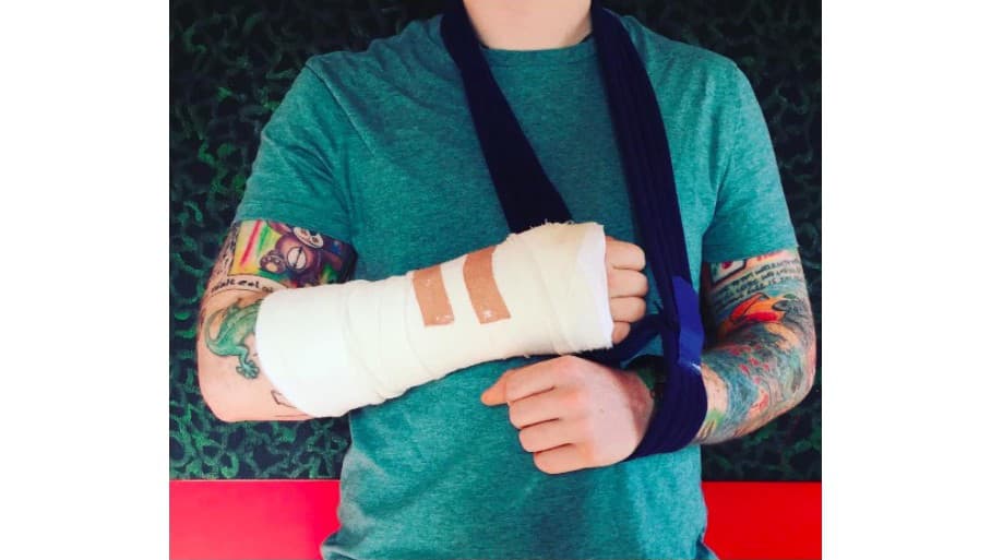 Ed Sheeran si pri nehode na bicykli zranil ruku